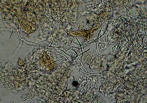 Stromatoscypha fimbriata 8 Pers.:Fr.)Donk